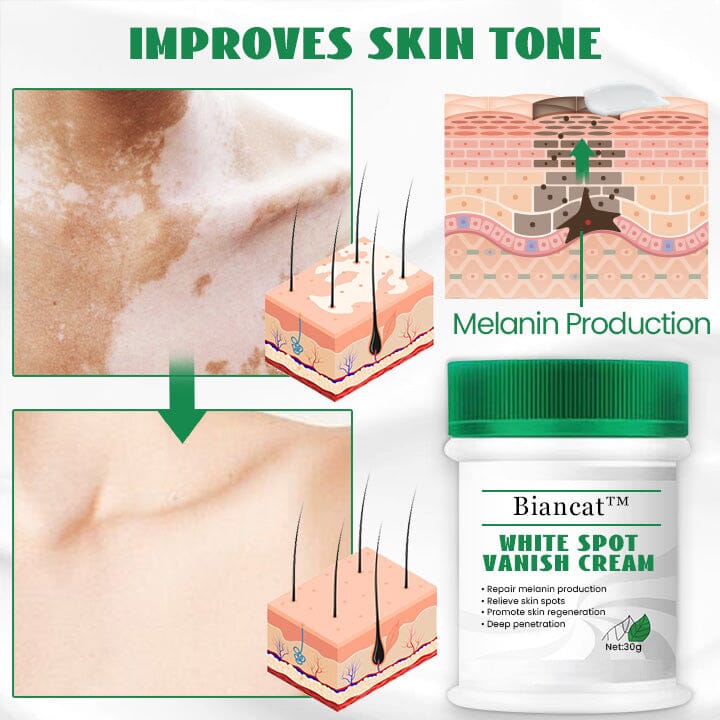 Biancat™ White Spot Vanish Cream English CSXL