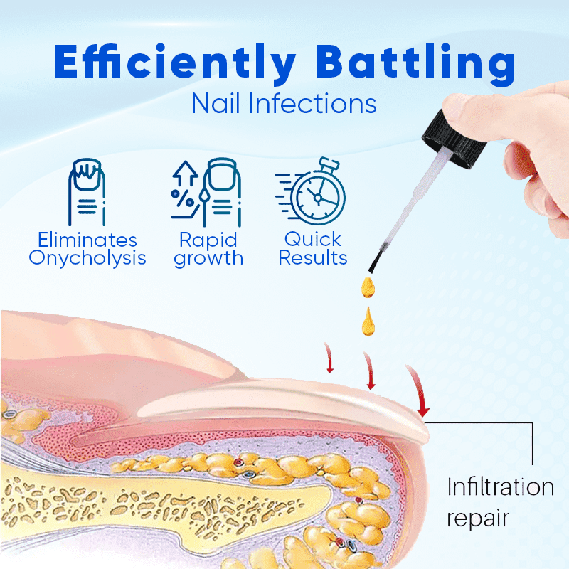 Biancat™ OnyxoGuard Nail Growth and Repair Serum English JVJM-3