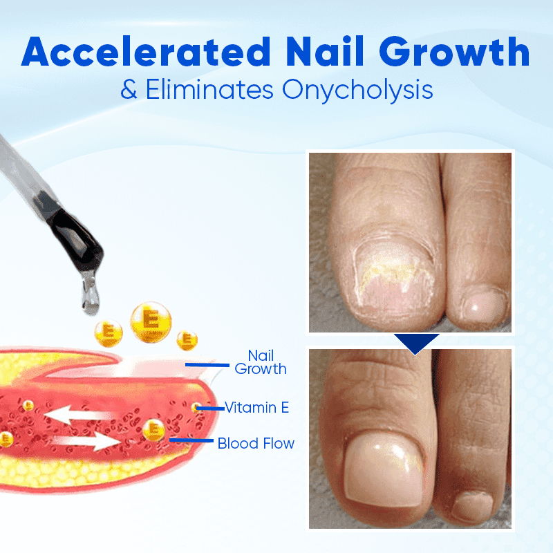 Biancat™ OnyxoGuard Nail Growth and Repair Serum English JVJM-3
