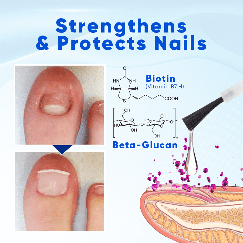 Biancat™ OnyxoGuard Nail Growth and Repair Serum English JVJM-3