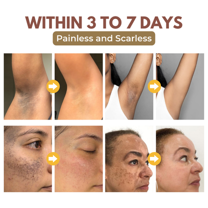 Biancat™ GlowRevive Skin Exfoliating Gel