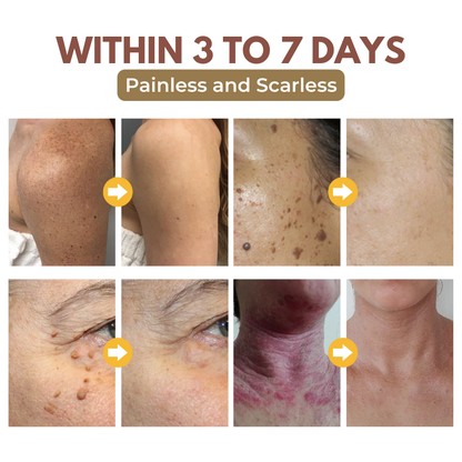 Biancat™ GlowRevive Skin Exfoliating Gel