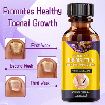 Ceoerty™ FungiShield Bee Venom Toenail Serum English CLXH 