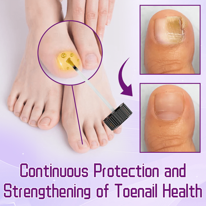 Ceoerty™ FungiShield Bee Venom Toenail Serum English CLXH 