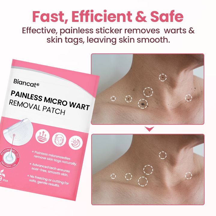 Biancat® Painless Micro Wart Removal Patch