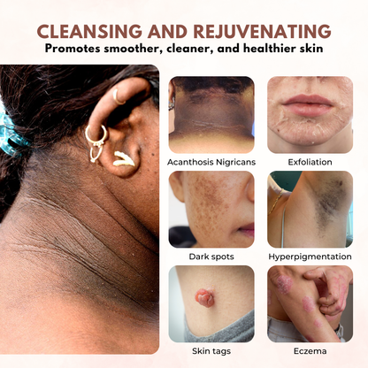 Biancat™ GlowRevive Skin Exfoliating Gel