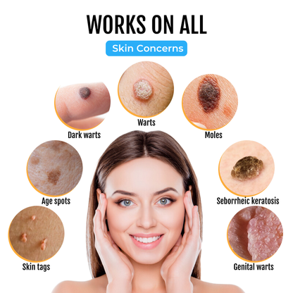 Biancat™ TagClear Moles & Warts Removal Serum