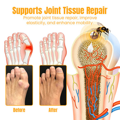 Ceoerty™ MelittinPRO Bee Venom Joint Repair Cream - 👨‍⚕️ American Orthopaedic Association (AOA) Approved